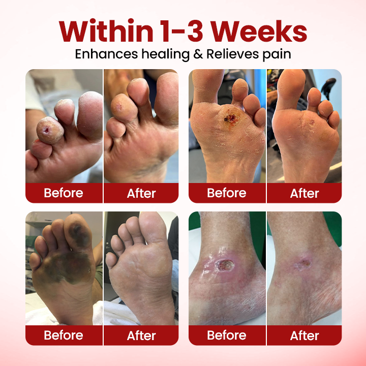 SEAGRIL® VitaGluco Diabetic Care Cream