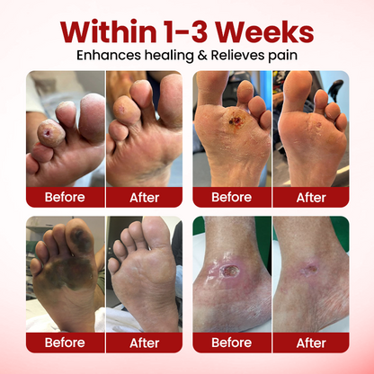 SEAGRIL® VitaGluco Diabetic Care Cream