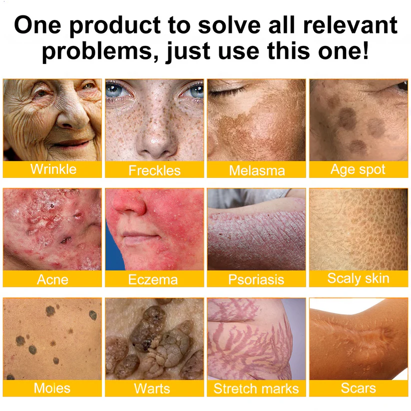 ✨FDA Approved: SEAGRIL® Bee Venom Skin Restoration Cream — 🔥Limited Time 50% OFF🔥