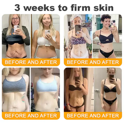 Made and Shipped from USA ✨ Tiworld® Bee Venom Skin Restoration Cream ⏰ LAST DAY 80% OFF💌