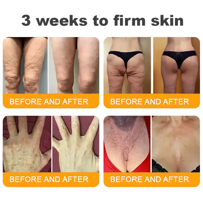 Made and Shipped from USA ✨ Tiworld® Bee Venom Skin Restoration Cream ⏰ LAST DAY 80% OFF💌