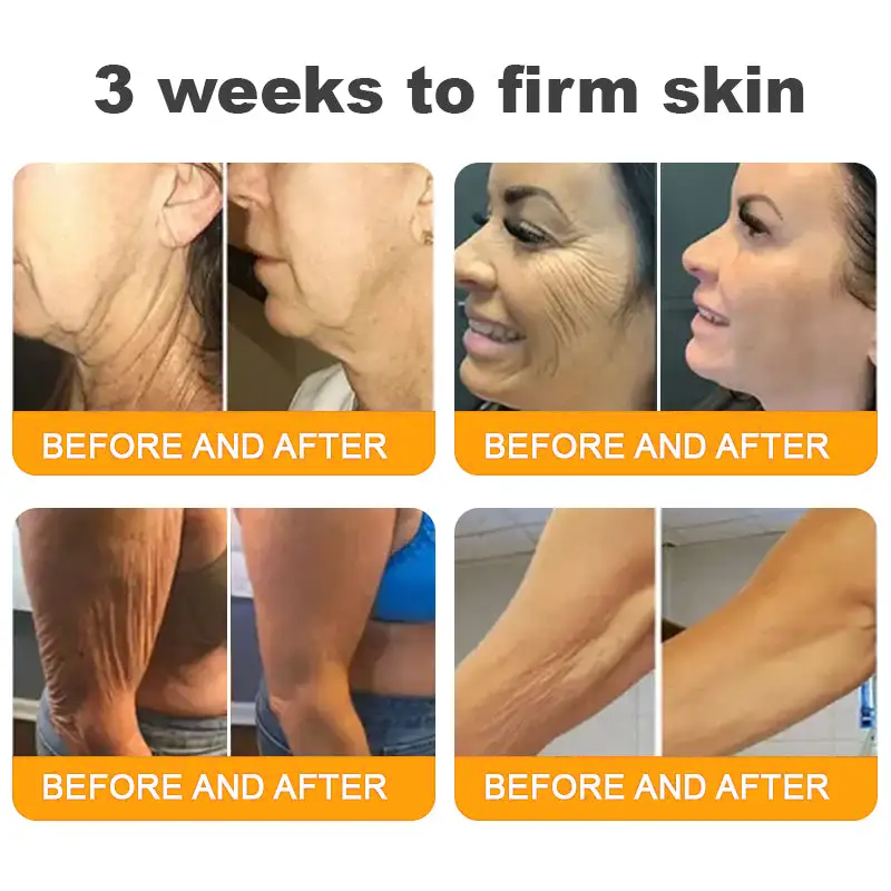 Made and Shipped from USA ✨ Tiworld® Bee Venom Skin Restoration Cream ⏰ LAST DAY 80% OFF💌