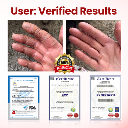 SEAGRIL® VitaGluco Diabetic Care Cream