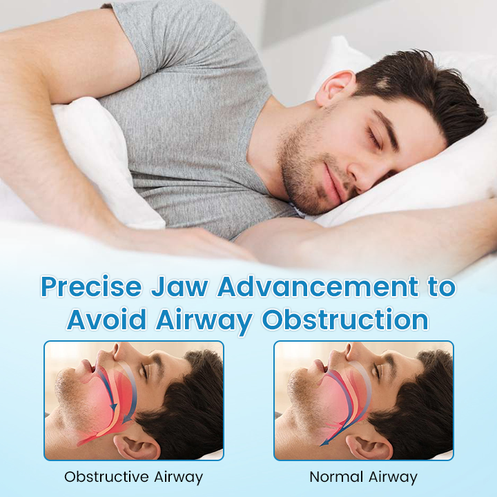 ✨[Official Brand Store]Adjustable Anti-Snoring Mouthpiece Universal Size