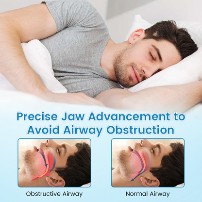 ✨[Official Brand Store]Adjustable Anti-Snoring Mouthpiece Universal Size