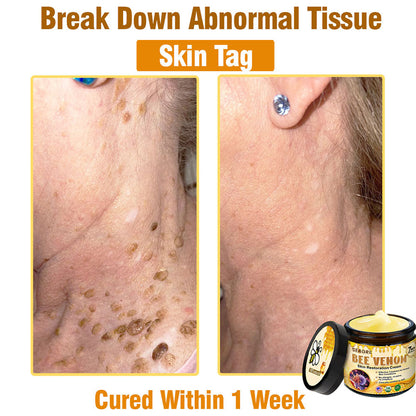 ✨FDA Approved: SEAGRIL® Bee Venom Skin Restoration Cream — 🔥Limited Time 50% OFF🔥