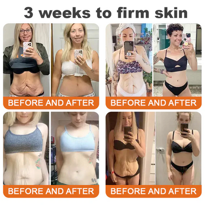 ✨FDA Approved: SEAGRIL® Bee Venom Skin Restoration Cream — 🔥Limited Time 50% OFF🔥