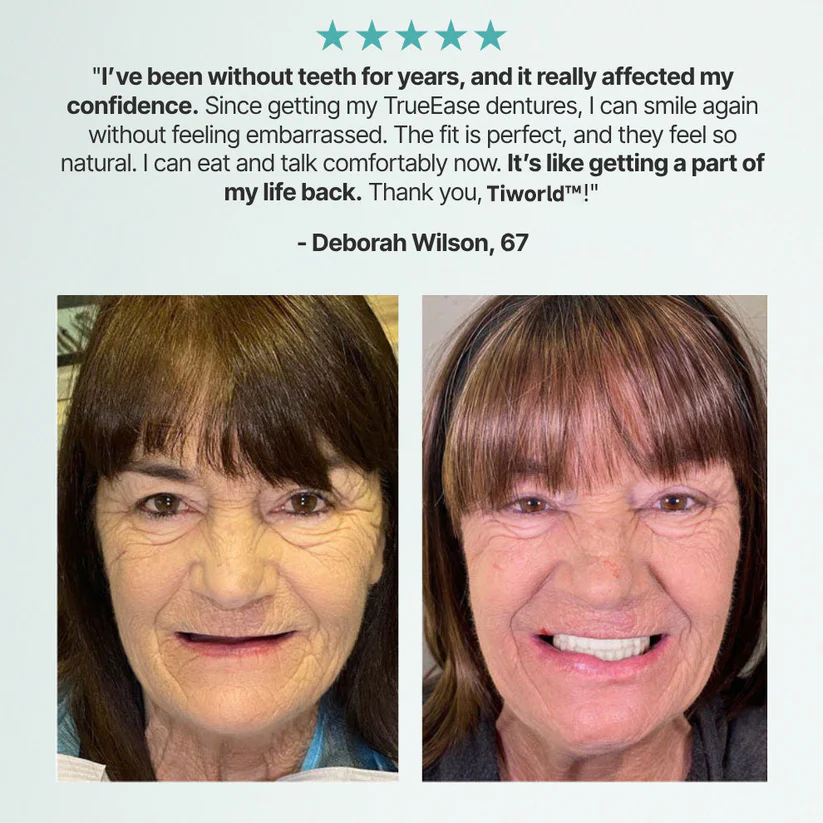 ✨Ends Today: 70% OFF! Tiworld™⏰ Custom-Fit Full Functional Dentures Make you more confident